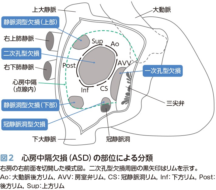 小児循環器入門 – 日本医事新報社